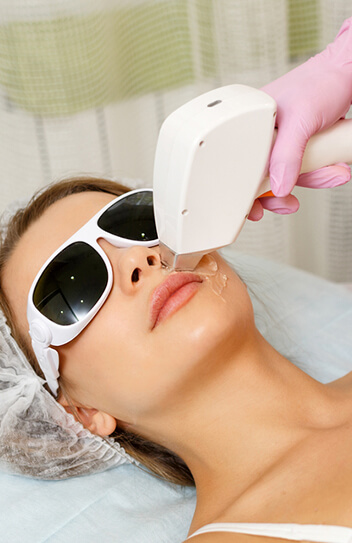 permanent hair removal treatment